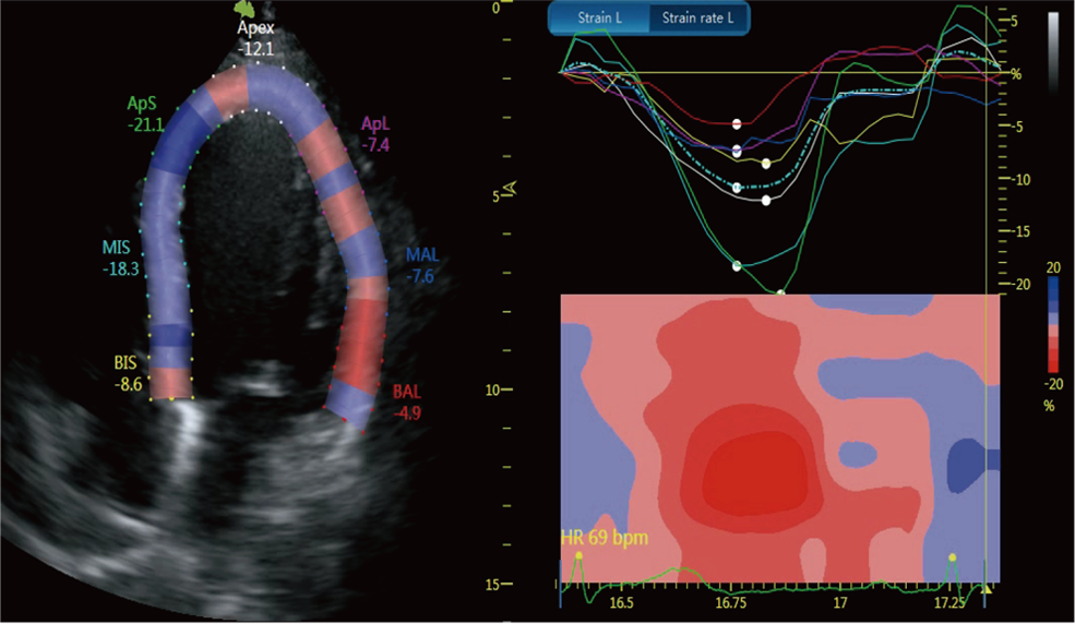 hình ảnh siêu âm tim mạch vinno M86