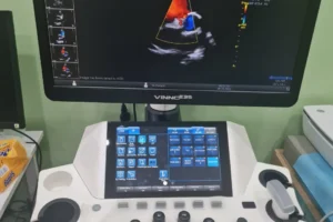 siêu âm tim vinno e35