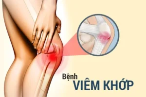 bệnh viêm khớp
